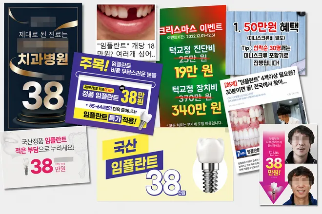 할인가와 이벤트, 치료 전후사진이 뒤섞인 광고물 여러 장